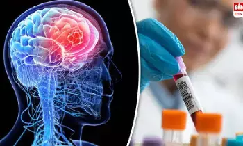 Brain Cancers:గంటలో మెదడు క్యాన్సర్ను గుర్తించే పరికరం Brain Cancers:గంటలో మెదడు క్యాన్సర్ను గుర్తించే పరికరం