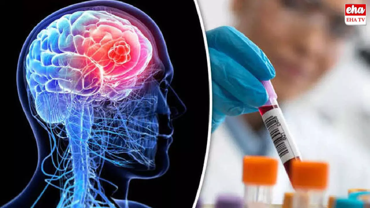 Brain Cancers:గంటలో మెదడు క్యాన్సర్ను గుర్తించే పరికరం Brain Cancers:గంటలో మెదడు క్యాన్సర్ను గుర్తించే పరికరం