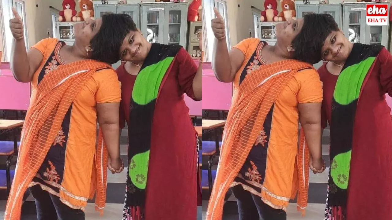 Veena Vani Birthday Celebrations:అవిభక్త కవలలు వీణ-వాణిలకు బర్త్డే విషెస్.. కలసిన తనువులు విడిపోయేది ఎప్పుడో! Veena Vani Birthday Celebrations:అవిభక్త కవలలు వీణ-వాణిలకు బర్త్డే విషెస్.. కలసిన తనువులు విడిపోయేది ఎప్పుడో!