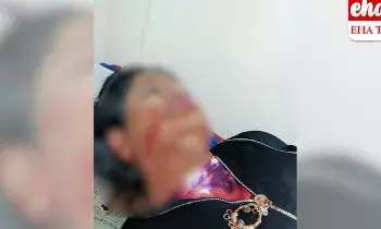 ఫోన్ ఇవ్వలేదని.. తల్లిపై కొడుకు కత్తితో దాడి ఫోన్ ఇవ్వలేదని.. తల్లిపై కొడుకు కత్తితో దాడి
