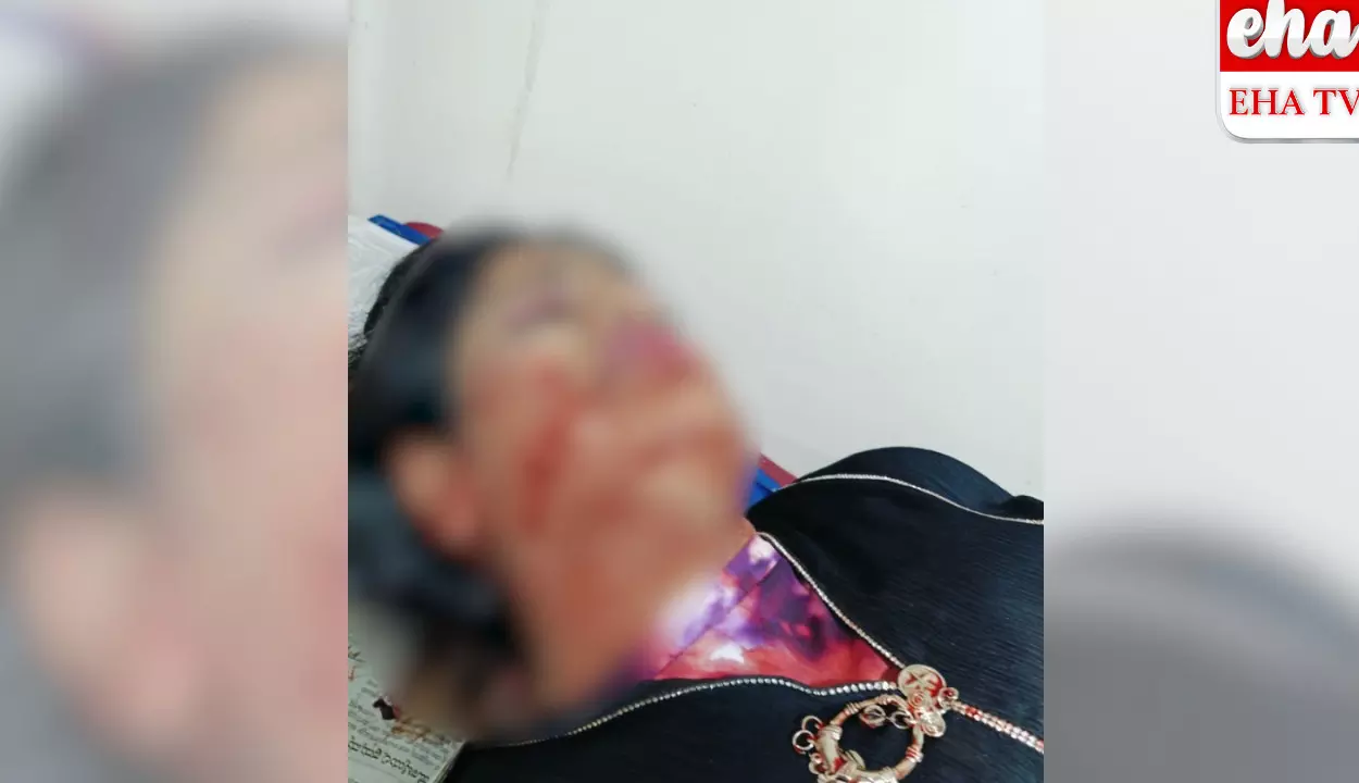 ఫోన్ ఇవ్వలేదని.. తల్లిపై కొడుకు కత్తితో దాడి ఫోన్ ఇవ్వలేదని.. తల్లిపై కొడుకు కత్తితో దాడి
