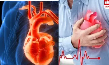 Heart Stroke: గుండెపోటు వచ్చే నెల ముందు వచ్చే సంకేతాలు..! Heart Stroke: గుండెపోటు వచ్చే నెల ముందు వచ్చే సంకేతాలు..!