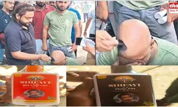 Uppal Baldness Treatment Scam : బట్టతలపై వెంట్రుకలు.. ఉప్పల్లో మరో మోసం..! Uppal Baldness Treatment Scam : బట్టతలపై వెంట్రుకలు.. ఉప్పల్లో మరో మోసం..!