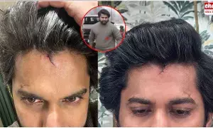 HIT-3 Movie Shoot : హీరో నానికి తలకు గాయం..! HIT-3 Movie Shoot : హీరో నానికి తలకు గాయం..!