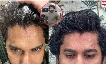 HIT-3 Movie Shoot : హీరో నానికి తలకు గాయం..! HIT-3 Movie Shoot : హీరో నానికి తలకు గాయం..!