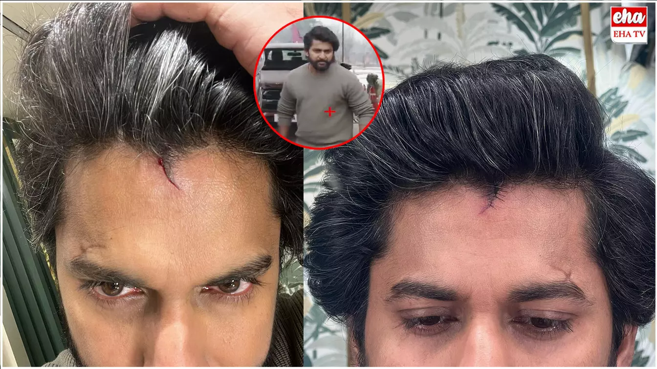 HIT-3 Movie Shoot : హీరో నానికి తలకు గాయం..! HIT-3 Movie Shoot : హీరో నానికి తలకు గాయం..!