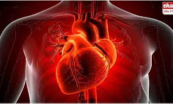 Cardiac Death : ఆకస్మిక గుండెపోటు మరణాలకు ఏఐతో చెక్... అమెరికా పరిశోధకుల కీలక ఆవిష్కరణ Cardiac Death : ఆకస్మిక గుండెపోటు మరణాలకు ఏఐతో చెక్... అమెరికా పరిశోధకుల కీలక ఆవిష్కరణ