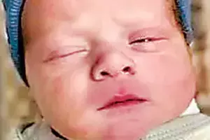 1994 IVF: 1994లో పిండం భద్రపర్చగా.. ఇప్పుడు శిశివుగా జననం..! 1994 IVF: 1994లో పిండం భద్రపర్చగా.. ఇప్పుడు శిశివుగా జననం..!
