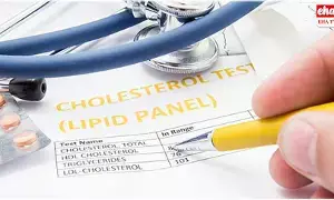 Lipid Profile Explained : లిపిడ్ ప్రొఫైల్ అంటే ఏమిటి?--> ఓ వైద్యుడి అద్భుత వివరణ Lipid Profile Explained : లిపిడ్ ప్రొఫైల్ అంటే ఏమిటి?--> ఓ వైద్యుడి అద్భుత వివరణ