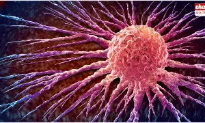 Northwestern University  : సాధారణ క్యాన్సర్‌ ఇంజెక్షన్‌ కంటే 20 వేల రెట్లు ఎఫీషియెంట్‌గా పనిచేసే క్యాన్సర్‌ ఇంజెక్షన్..!