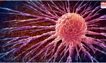 Northwestern University  : సాధారణ క్యాన్సర్‌ ఇంజెక్షన్‌ కంటే 20 వేల రెట్లు ఎఫీషియెంట్‌గా పనిచేసే క్యాన్సర్‌ ఇంజెక్షన్..!