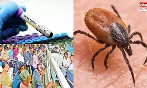 Scrub Typhus : ఏపీని వణికిస్తున్న స్క్రబ్ టైఫస్ Scrub Typhus : ఏపీని వణికిస్తున్న స్క్రబ్ టైఫస్