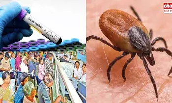 Scrub Typhus : ఏపీని వణికిస్తున్న స్క్రబ్ టైఫస్ Scrub Typhus : ఏపీని వణికిస్తున్న స్క్రబ్ టైఫస్