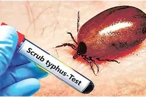 Scrub Typhus :  ఏపీలో స్క్రబ్ టైఫస్ కేసుల భయం..భయం.. 20కి చేరిన మృతులు..!