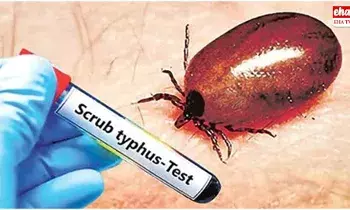 Scrub Typhus :  ఏపీలో స్క్రబ్ టైఫస్ కేసుల భయం..భయం.. 20కి చేరిన మృతులు..!