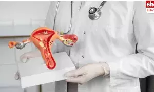 16 kg of fibroids: 30 ఏళ్ల మహిళ గర్భాశంయలో 16 కిలోల ఫైబ్రాయిడ్..!