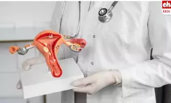 16 kg of fibroids: 30 ఏళ్ల మహిళ గర్భాశంయలో 16 కిలోల ఫైబ్రాయిడ్..!