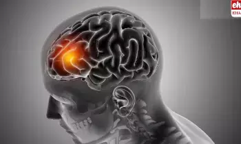 Stroke Symptoms:  నిద్రలేవగానే ఈ లక్షణాలు కన్పిస్తే స్ట్రోక్ వస్తున్నట్లే..!